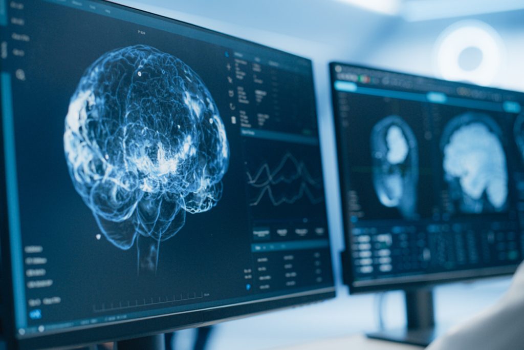 Scintigraphies cérébrales médicales sur plusieurs écrans d’ordinateur.